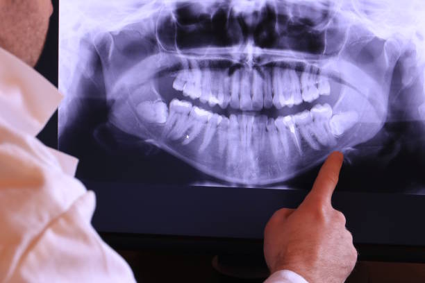 Best Chipped Tooth Repair Near Me  in Chester Heights, PA
