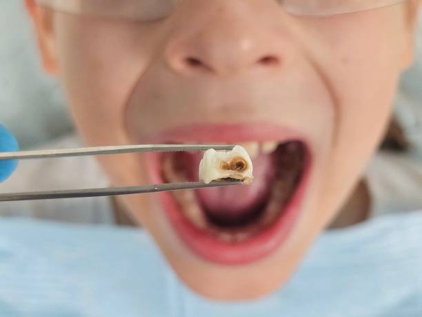 Best Emergency Gum Pain Relief  in Chester Heights, PA